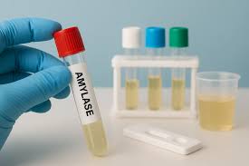 Amylase Test